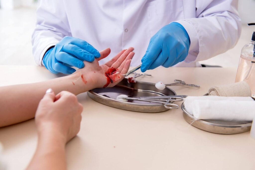 A doctor performing a surgical procedure on a patient hand with a scalpel